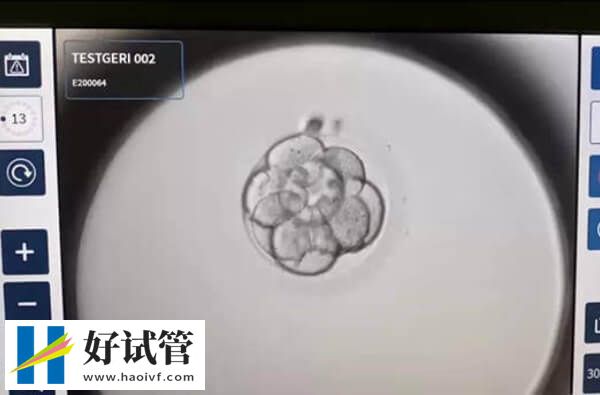 卵泡直径为18-22mm算成熟卵泡