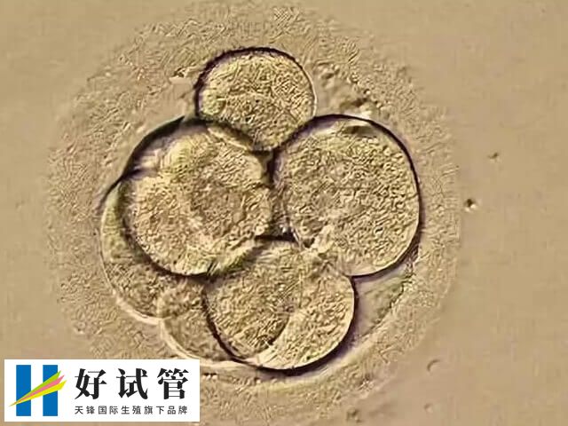 一卵多精可考虑辅助孵化技术改善