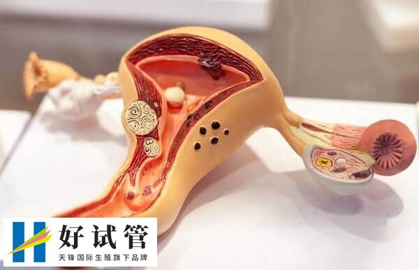 达菲林就可治疗子宫腺肌症