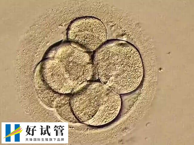 4BA囊胚属于优质囊胚